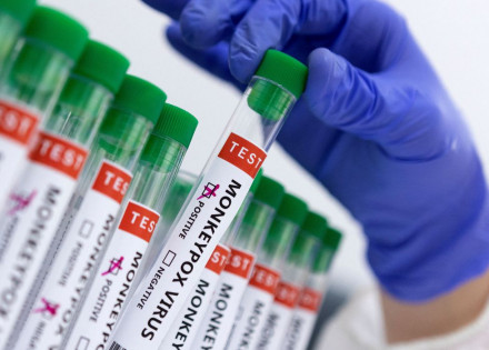 2022-05-23t181955z_913412699_rc25du9e79sc_rtrmadp_3_health-monkeypox1