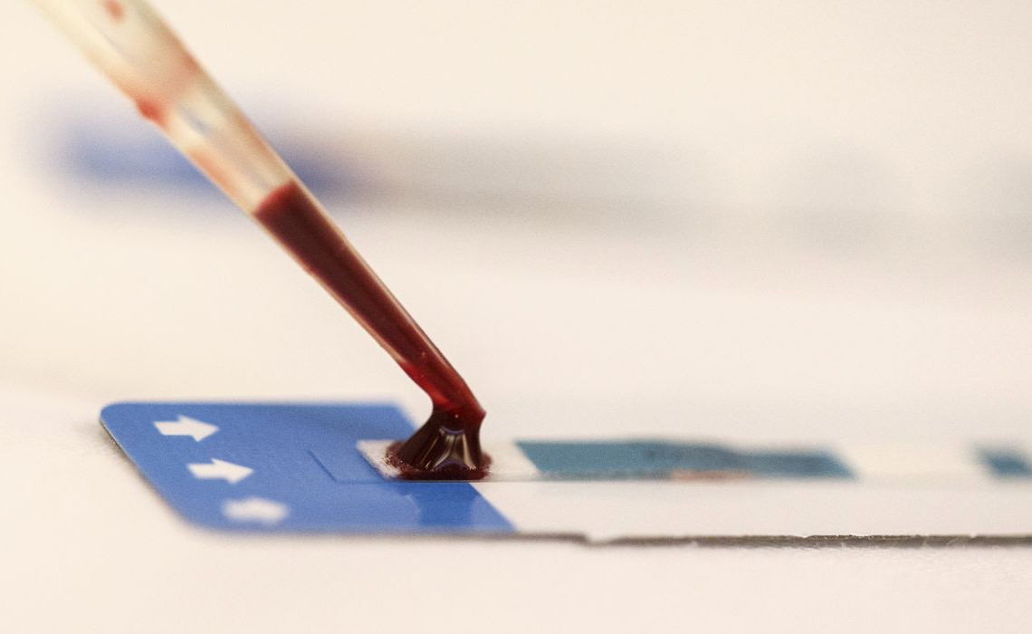 Teste de HIV