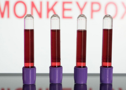 2022-06-18t000000z_759885760_mt1nurpho000kmrwk2_rtrmadp_3_monkeypox