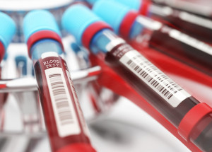 entenda-como-funciona-a-doacao-de-medula-ossea-no-pais-correio-nogueirense