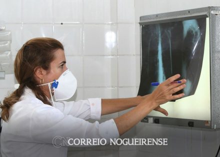 brasil-registra-78-mil-novos-casos-de-tuberculose-correio-nogueirense