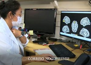 estudos-apresentados-na-unicamp-tracam-sequelas-da-covid-19-no-cerebro-correio-nogueirense