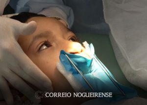 genetica-e-inflamacao-na-gravidez-explicam-labio-leporino-correio-nogueirense