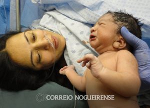 morte-materna-teve-alta-na-pandemia-e-preocupa-orgaos-de-saude-correio-nogueirense