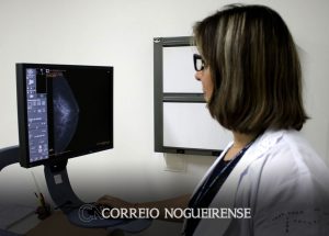 pesquisa-mostra-desconhecimento-sobre-prevencao-do-cancer-de-mama-correio-nogueirense