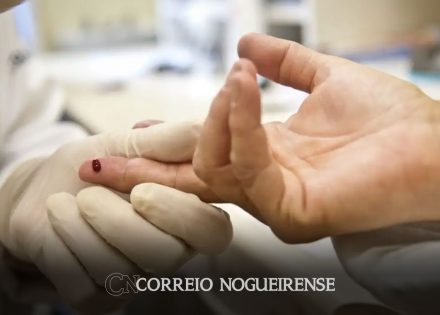 casos-de-sifilis-e-de-hiv-aids-aumentam-entre-homens-jovens-correio-nogueirense