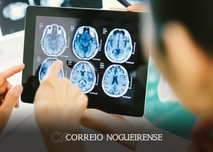 estudo-descobre-possivel-caminho-para-apontar-gravidade-de-cancer-no-cerebro-correio-nogueirense