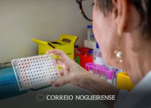 butantan-desenvolve-teste-que-detecta-leptospirose-em-estagio-inicial-correio-nogueirense