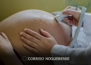 casos-de-dengue-em-gestantes-aumentam-345-em-2024-correio-nogueirense