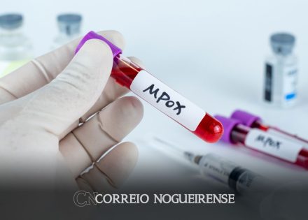 governo-do-estado-reforca-vigilancia-e-monitoramento-da-mpox-correio-nogueirense