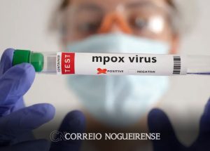 brasil-supera-marca-de-mil-casos-de-mpox-em-2024-correio-nogueirense