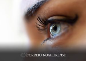 procedimentos-esteticos-sem-cautela-podem-causar-complicacoes-oculares-correio-nogueirense
