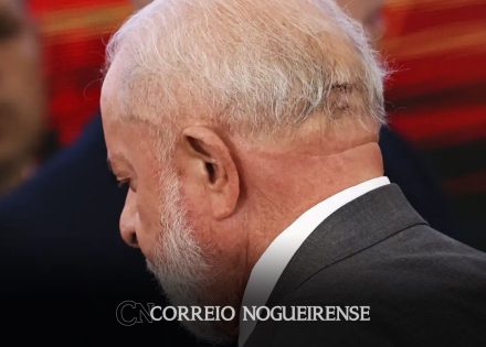 lula-vai-a-hospital-e-retira-pontos-de-corte-apos-queda-correio-nogueirense