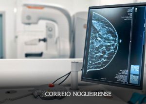 agendamento-de-mamografia-na-rede-estadual-passa-a-ser-feito-tambem-pelo-aplicativo-do-poupatempo-correio-nogueirense