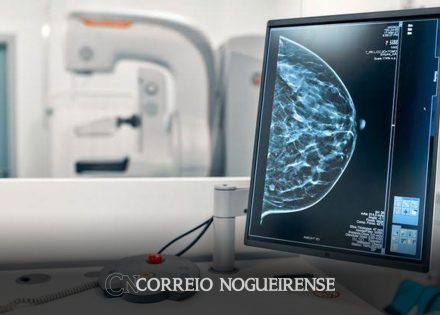 agendamento-de-mamografia-na-rede-estadual-passa-a-ser-feito-tambem-pelo-aplicativo-do-poupatempo-correio-nogueirense