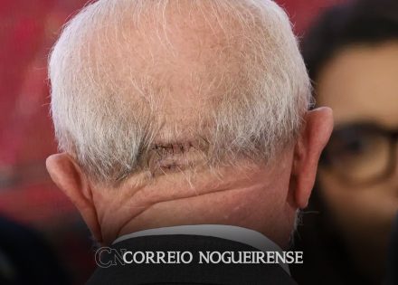 lula-recebe-liberacao-medica-para-viajar-de-aviao-correio-nogueirense
