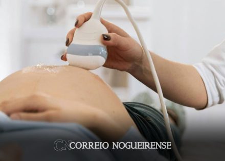 oms-300-mil-mulheres-morrem-anualmente-em-razao-de-gravidez-ou-parto-correio-nogueirense