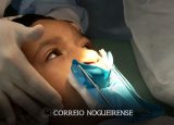 lula-sanciona-lei-que-obriga-cirurgia-de-labio-leporino-no-sus-correio-nogueirense