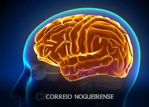 entenda-a-hidrocefalia-normobarica-causa-da-cirurgia-de-chico-buarque-correio-nogueirense