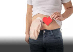 camara-de-artur-nogueira-aprova-lei-que-estabelece-o-atendimento-preferencial-as-pessoas-que-utilizam-bolsa-de-colostomia-ileostomia-e-urotosmia-correio-nogueirense