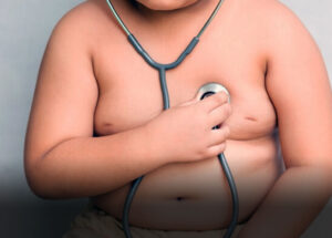 obesidade-infantil-causa-danos-vasculares-precoces-indica-estudo-correio-nogueirense