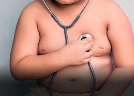 obesidade-infantil-causa-danos-vasculares-precoces-indica-estudo-correio-nogueirense
